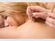 Equilibrium Acupuncture