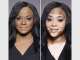 Vitiligo Solutions Clinic
