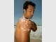Vitiligo Solutions Clinic